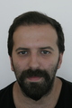 Laser-Hair-Transplant-after Laser-Hair-Transplant-after
