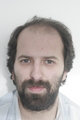 Laser-Hair-Transplant-before- Laser-Hair-Transplant-before-
